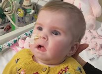 Quello che non si vuole capire della vicenda della piccola Indi Gregory (di Franco Marino)